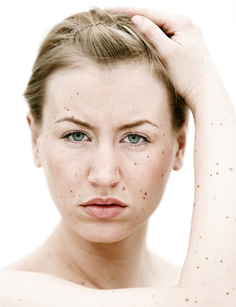  13 Weird Skin Spots You Should Definitely Get Checked Out