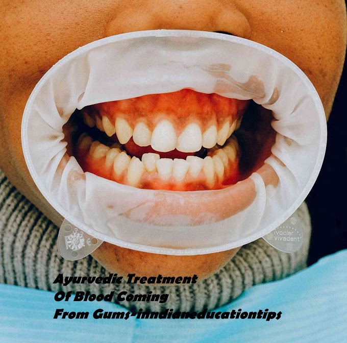 Ayurvedic Treatment Of Blood Coming From Gums In Hindi-Indianeducationtips