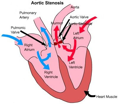 Heart Images