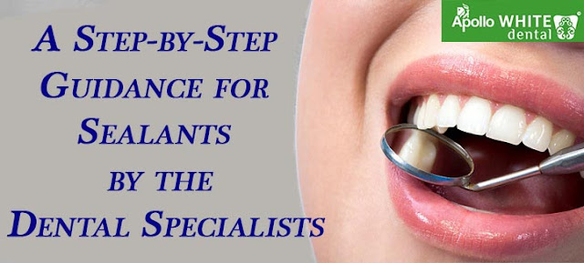 A Step-by-Step Guide for Sealants by the Dental Specialists 