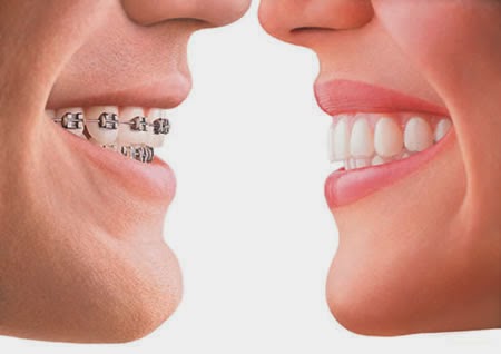 http://dentistrybangalore.com/ortho/