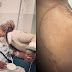 Banky W Undergoes 3rd Surgery Over A Rare Strain Of Skin Cancer Tumours (Photos) - International PhD Scholarship in Australia