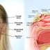 Is Sinusitis A Communicable Disease?