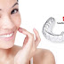 Kỹ thuật niềng răng clear aligner – thoải mái và tiện lợi