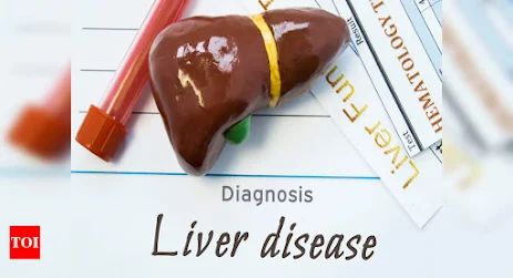 8 foods to avoid with liver disease