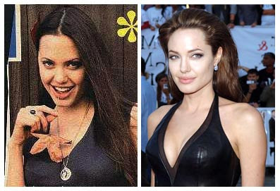 Angelina Jolie Plastic Surgery