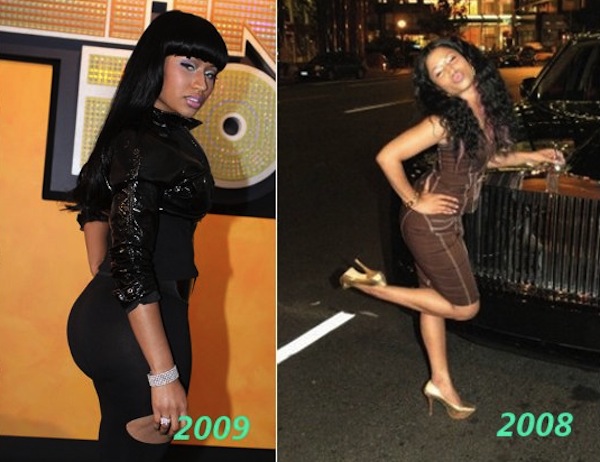 nicki minaj before after photos. nicki minaj implants efore