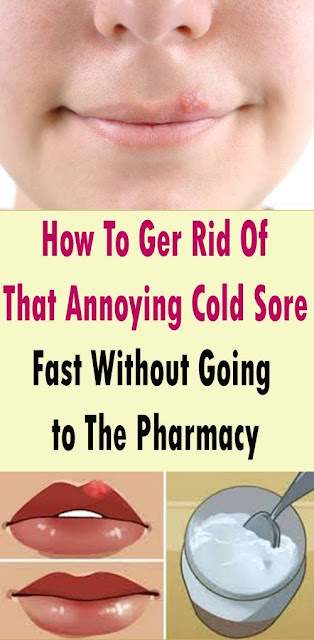 HOW TO GER RID OF THAT ANNOYING COLD SORE FAST WITHOUT GOING TO THE PHARMACY