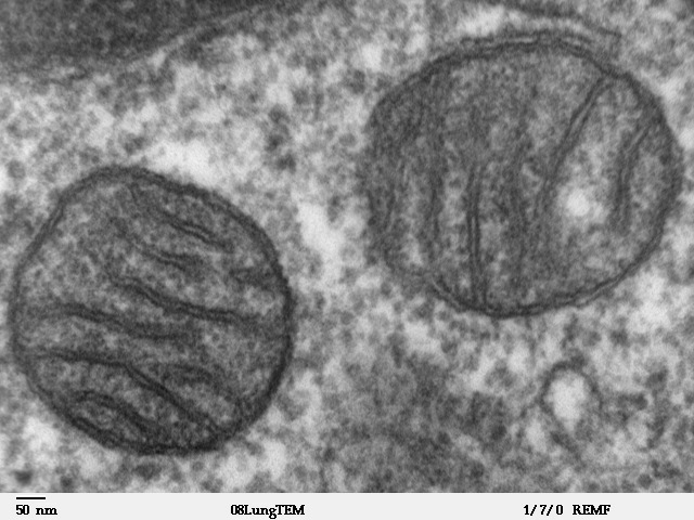 Power, Sex, Suicide: Mitochondria and the Meaning of Life by Nick Lane