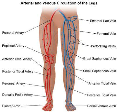 Peripheral Vascular Disease Pictures