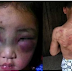  Gara Gara Merusak Bunag Keladi Ibunya,Anak Ini Disiksa Hingga Babak Belur,Semoga Cepat Sembuh.