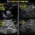 Rush Exam - Pdf Accuracy Of Rapid Ultrasound In Shock Rush Exam For Diagnosis Of Shock In Critically Ill Patients Semantic Scholar