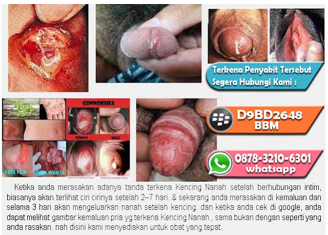 Solusi Mengatasi Gejala Kencing Bercampur Nanah