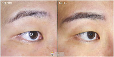 Immediate result after first Korean Eyebrow Embroidery with Ivy Brow Design (right eye)