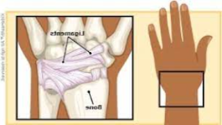 Wrist sprain treatments, diagnosis and symptoms in children and adolescents