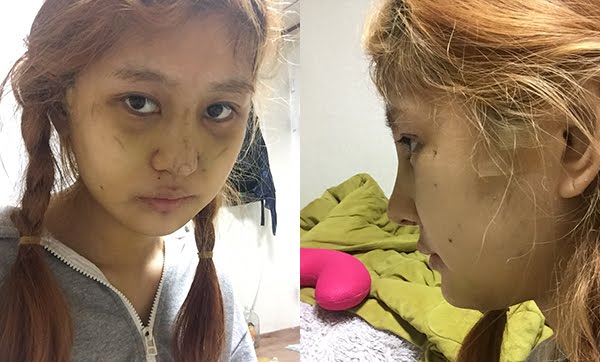 짱이뻐! - People Did Plastic Surgery Because Of This?