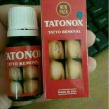  tattonox penghapus tatto surabaya