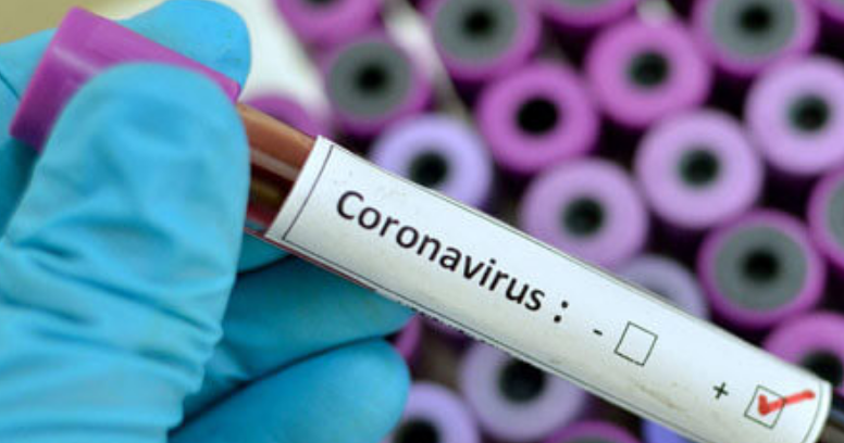 تسجيل 3 إصابات جديدة بفيروس كورونا بجهة سوس ماسة