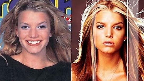 jessicasimpsonnosejob20%255B1%255D Hollywood Celebs Before & After Surgery