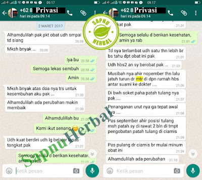 Cara Mengobati Radang Sendi Dengan Obat Herbal Yang Terbukti Paling Ampuh