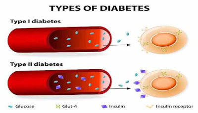 Cara Mengobati Luka Diabetes Secara Alami