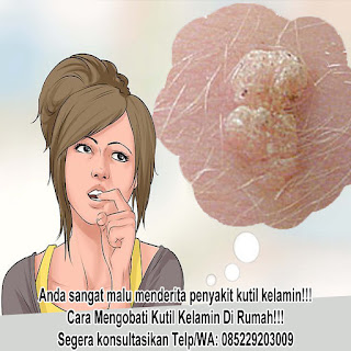 Obat kutil kelamin