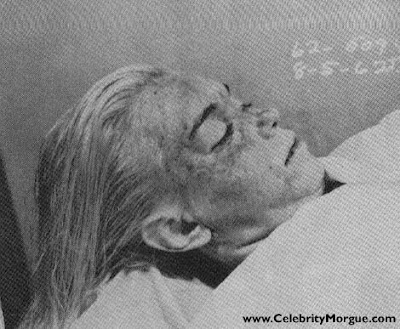 Dead Celebrity Pictures on Above  Marilyn Monroe Autopsy  Looks Like She Got The Shit Kicked Out