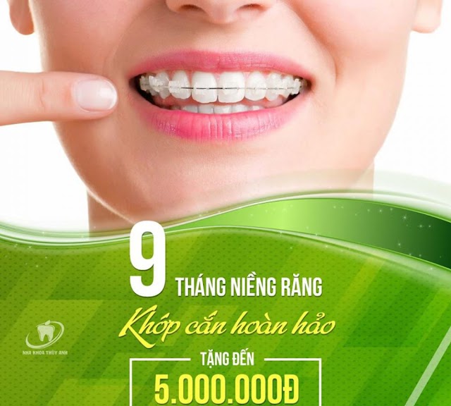 Thời gian niềng răng mất bao lâu thì đẹp? 