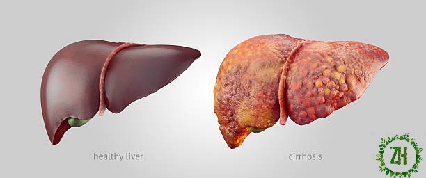 How To Preserve Your Liver Healthful Client Reports