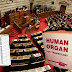 Σοκ: Τιμοκατάλογος ανθρώπινων οργάνων στη Βουλή!