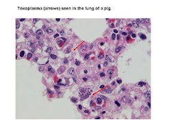 Tahukah Kamu tentang Toxoplasma?