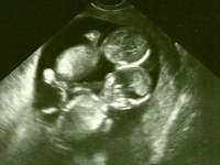 Mengandung Anak Kembar, Dokter Bilang "Jangan Bilang Siapa-siapa Dulu", Sampai Waktu Anaknya Lahir, Adegan Mengejutkan Terjadi!!