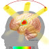 The Benefits Of Gamma Ray Radiation As An Alternative To Brain Neurosurgery