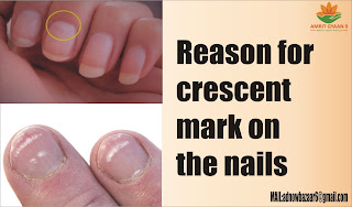 Reason for crescent mark on the nails