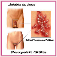 Obat Antibiotik Sipilis (Raja Singa) di Apotek yang Aman