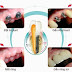 Thực hiện trồng răng sứ bằng công nghệ implant