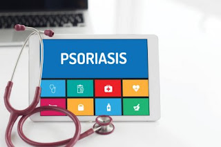 अपरस या सोरियेसिस ( Psoriasis ) is a life long skin disease