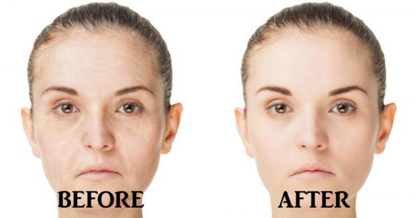 How to Make Your Face, Skin  Look Younger  And Flesh 