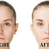 How to Make Your Face, Skin  Look Younger  And Flesh Without Make-Up.