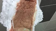 Ubat Bayi Berak Berdarah