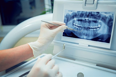 US Dental Imaging Market