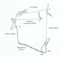 gambar analisis sefalometri