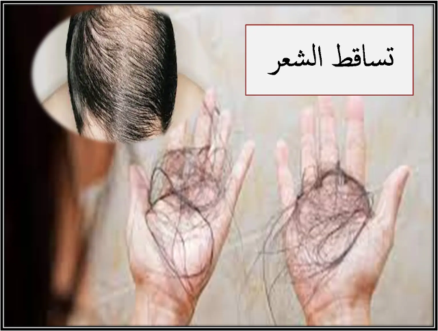 تساقط الشعر - هل يتساقط شعرك ؟ الاعراض و الاسباب و نصائح للعلاج.