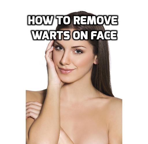 It is a fact that no one likes to have warts on one's face which is why many people want to get rid of face warts. Read on to find out more.