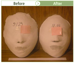 [Yakson program] Clinical trial results of face resizing care