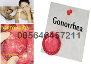 Jenis Obat Herbal Untuk Bakteri Gonorrhea