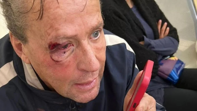 Alfredo Adame es golpeado  y le desprenden retina de ojo por andar grabando a victima en una balacera