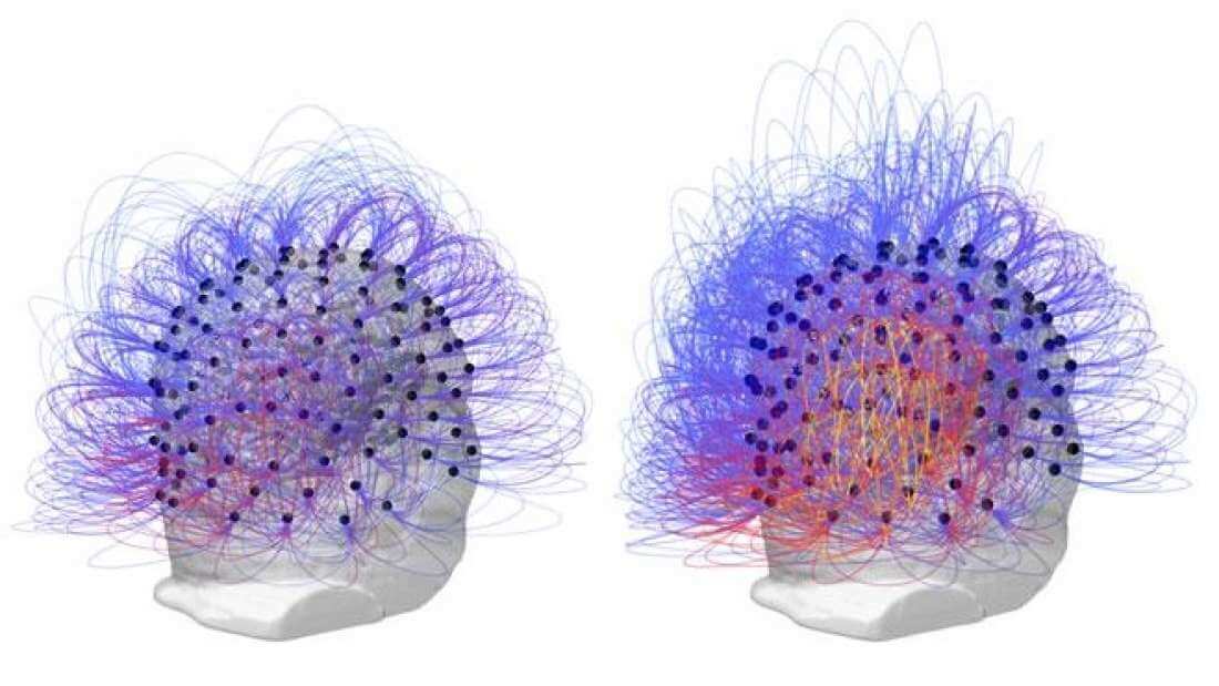 Scientists Managed To Restore Consciousness In A Man Who Spent Half Of His Life In A Comatose State