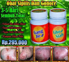 Obat Sipilis Kedokteran