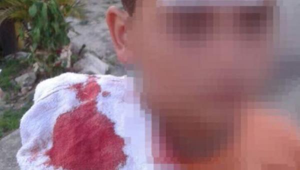 Guardia nacional hirió con perdigón en la cabeza a niño de 11 años en protesta en Táchira